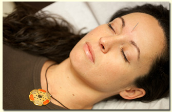 Acupuncture patient image